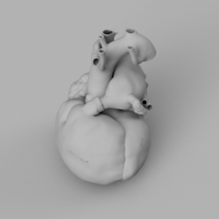 cuore-aneurisma-polmonare
