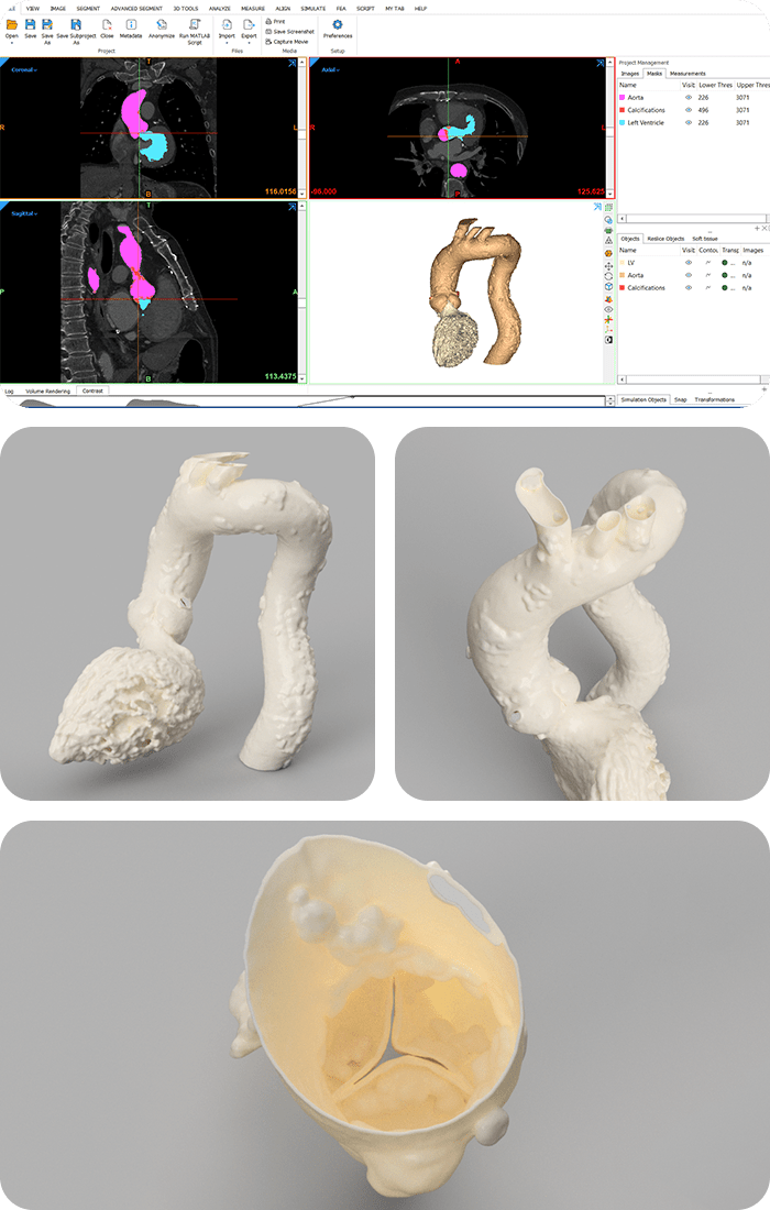 Qura: modelli 3D cuore per professionisti